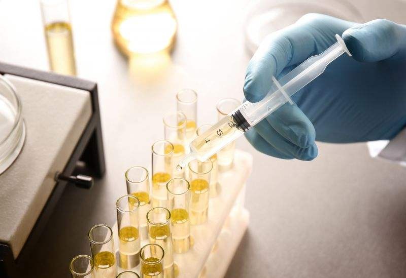 尿檢能檢測出來什么問題? 尿檢能檢測出來什么問題?